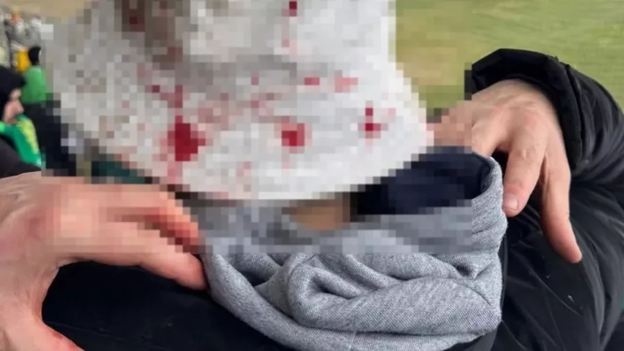 Whatsapp Image 2026 03 11 At 08 11 00 69B0Fa3748669