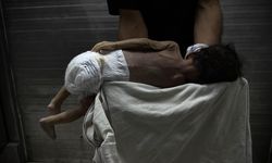 Soykırımcı İsrail'in kıtlığı dayattığı Gazze'de 453 kişi açlıktan hayatını kaybetti