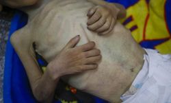 Katil İsrail'in ablukası nedeniyle kıtlık yaşanan Gazze’de açlıktan ölenlerin sayısı 455’e yükseldi