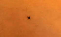 Bursa’da kene vakası: Çiftlikte oynayan çocuğun vücuduna yapıştı!