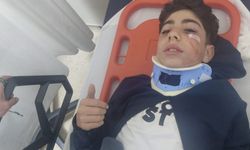 Bursa'da korkutan kaza! 12 yaşındaki bisikletli çocuğa otomobil çarptı