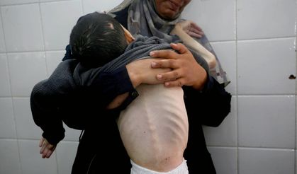 BM Gazze'de tam kıtlık hali ilan etti