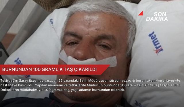 Burnundan 100 gramlık taş çıkarıldı