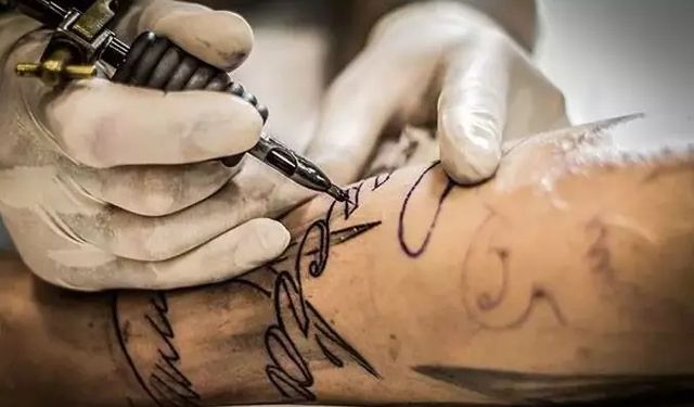 Son 5 yılda 1 milyondan fazla dövme sildirme işlemi uygulandı