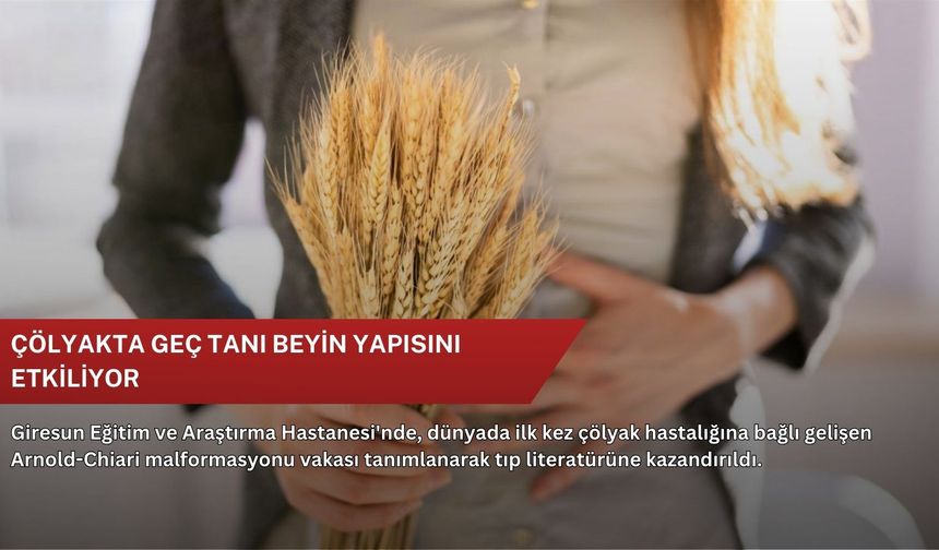 Çölyakta geç tanı beyin yapısını etkiliyor